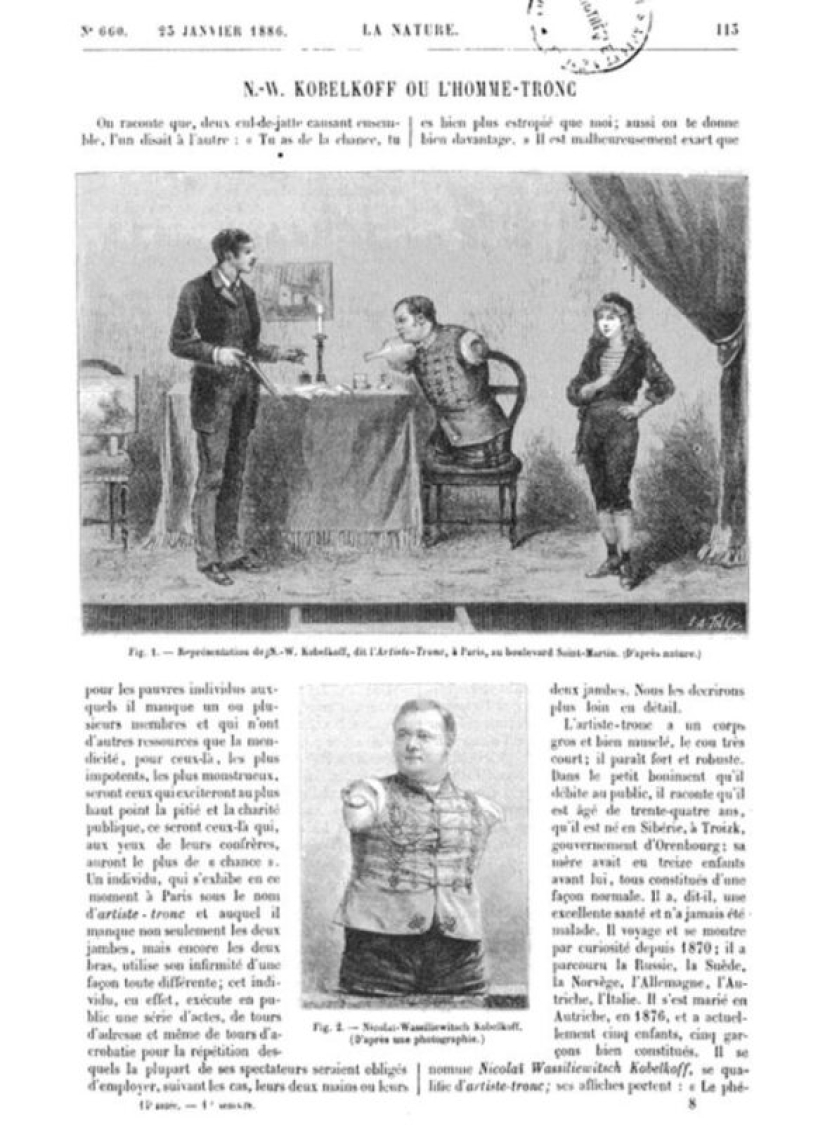 The story of Nikolai Kobelkov, or How a Russian without arms and without legs became an Austrian millionaire The story of Nikolai Kobelkov, or How a Russian without arms and without legs became an Austrian millionaire