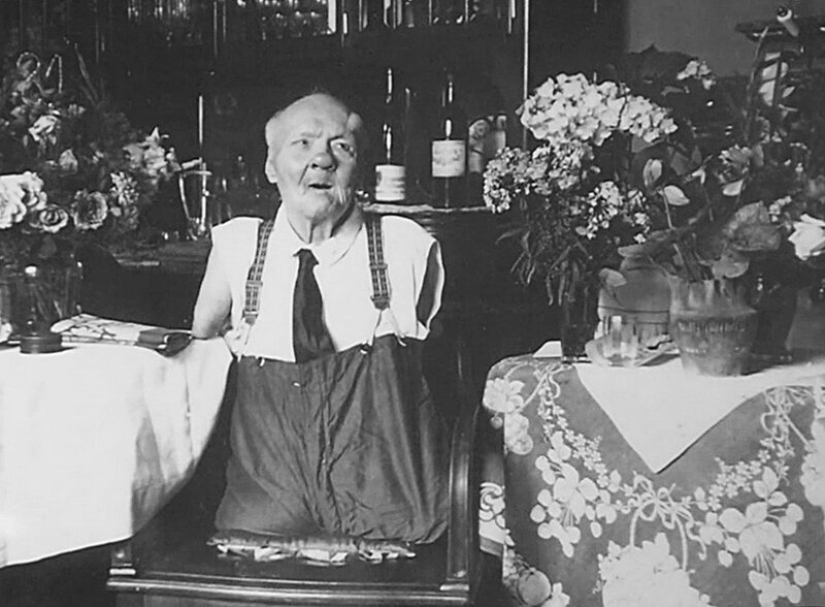 The story of Nikolai Kobelkov, or How a Russian without arms and without legs became an Austrian millionaire The story of Nikolai Kobelkov, or How a Russian without arms and without legs became an Austrian millionaire