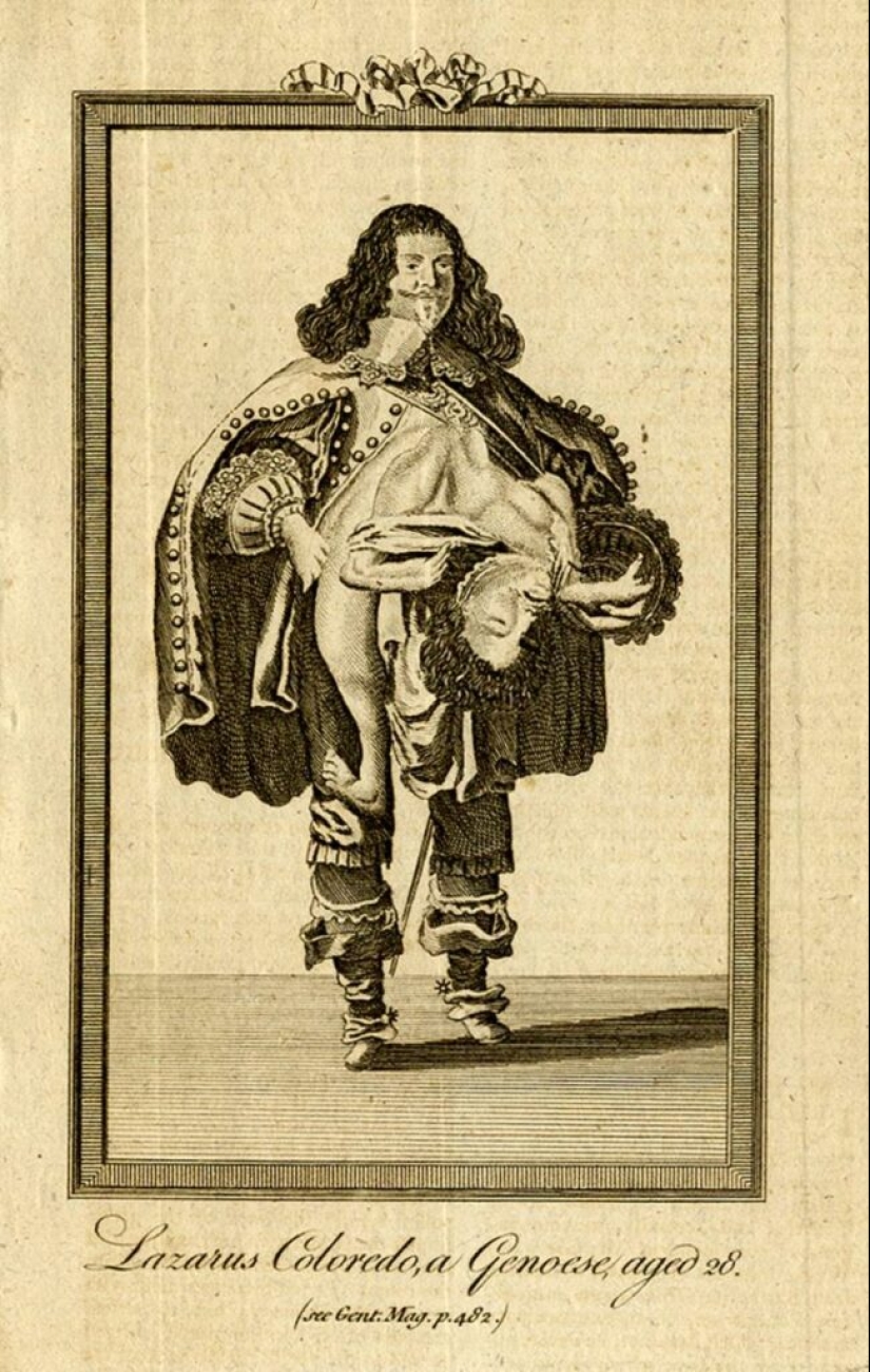 The story of the Siamese twins Colloredo, who managed to become musketeers of the King of France