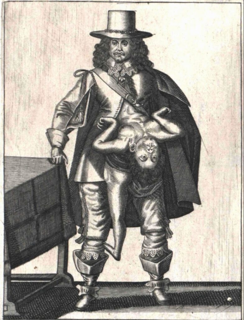 The story of the Siamese twins Colloredo, who managed to become musketeers of the King of France