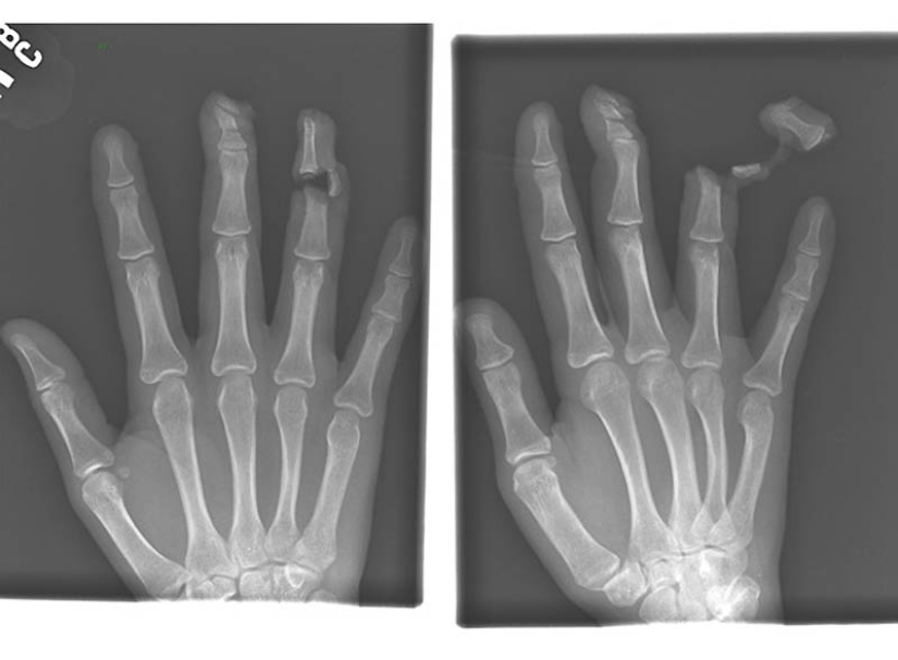 The strangest X-rays