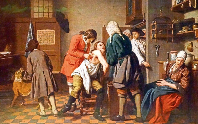 The terrible story of anesthesia, from mandrake root and strangulation, to the appearance of ether The terrible story of anesthesia, from mandrake root and strangulation, to the appearance of ether