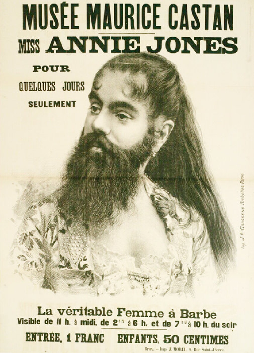 The tragic life of bearded women Annie Jones, who was a real lady