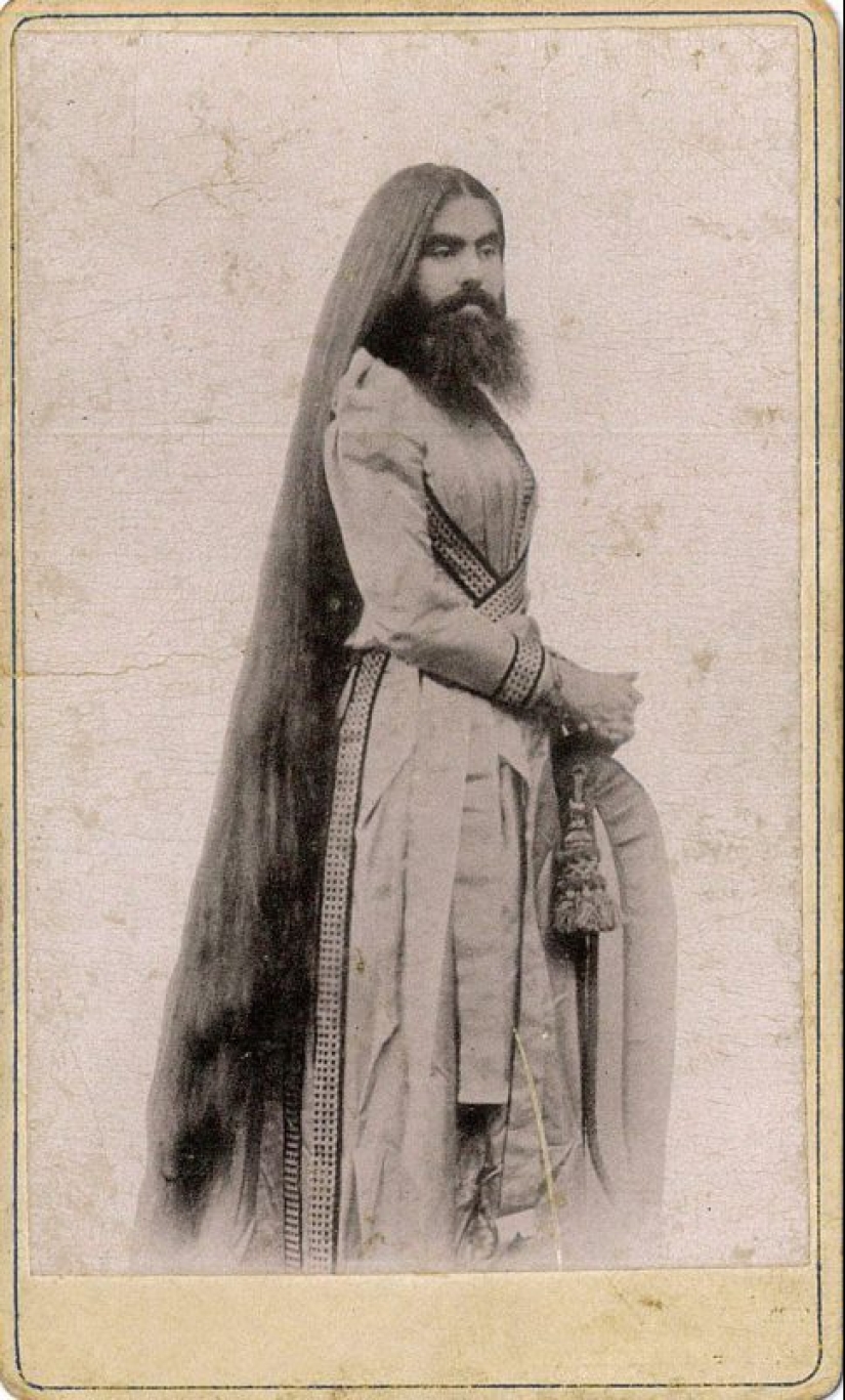 The tragic life of bearded women Annie Jones, who was a real lady