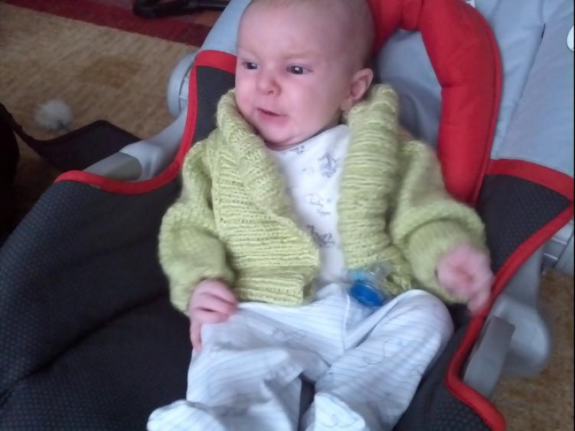 Toddlers who look like little old men