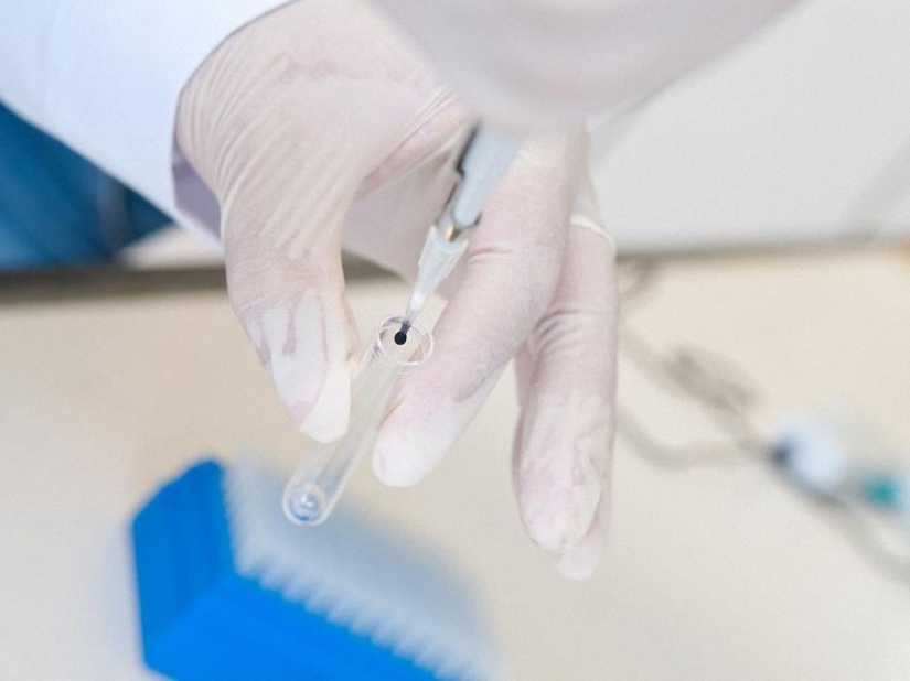 Todo lo que necesita saber sobre el virus de la gripe Todo lo que necesita saber sobre el virus de la gripe