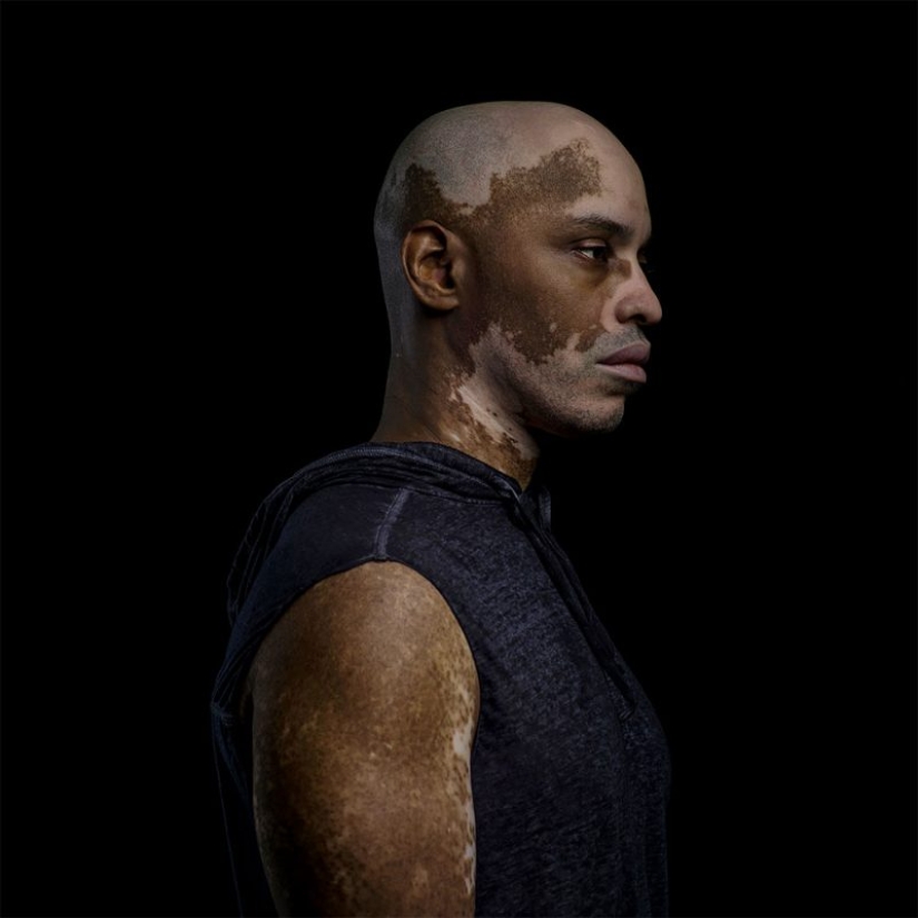 Unusual beauty: a unique photo project by Caesar Lima