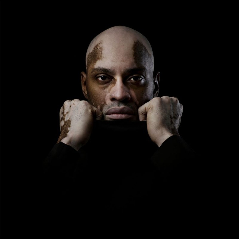 Unusual beauty: a unique photo project by Caesar Lima