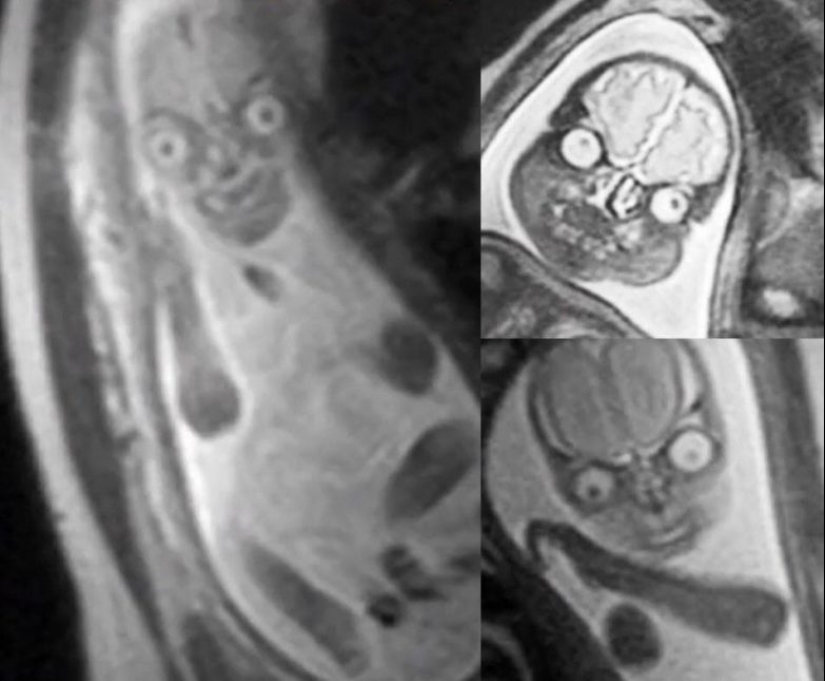 Up to goosebumps: 22 photos in which you see something terrible Up to goosebumps: 22 photos in which you see something terrible