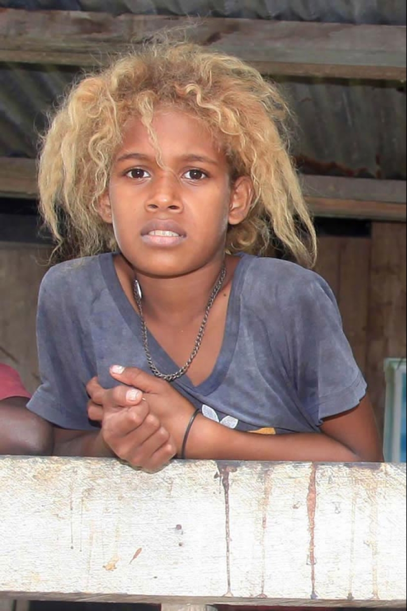 Why are dark-skinned blondes born in the Solomon Islands Why are dark-skinned blondes born in the Solomon Islands