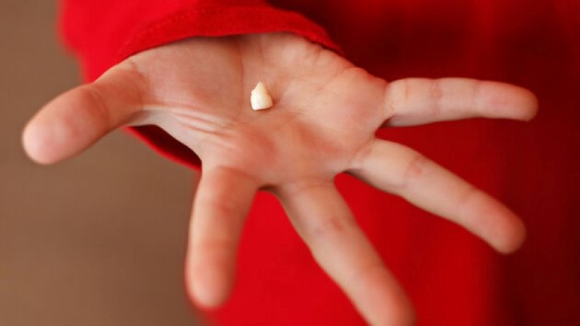 Why do you dream about tooth loss Why do you dream about tooth loss