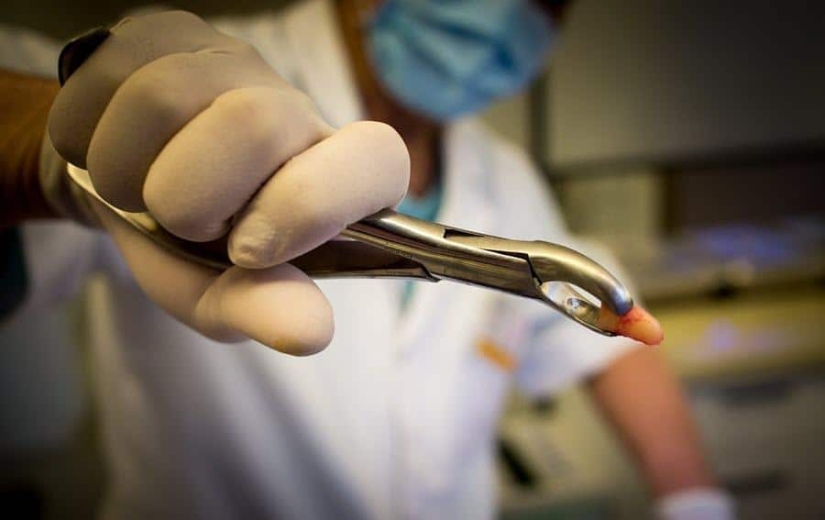 Why do you dream of losing teeth and is it worth being afraid of such a dream Why do you dream of losing teeth and is it worth being afraid of such a dream