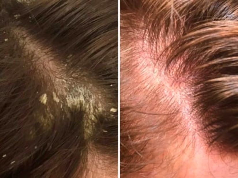 Without photoshop: 26 goods from online stores that have confirmed its effectiveness