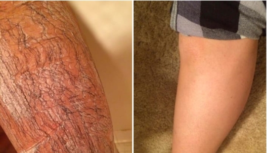 Without photoshop: 26 goods from online stores that have confirmed its effectiveness