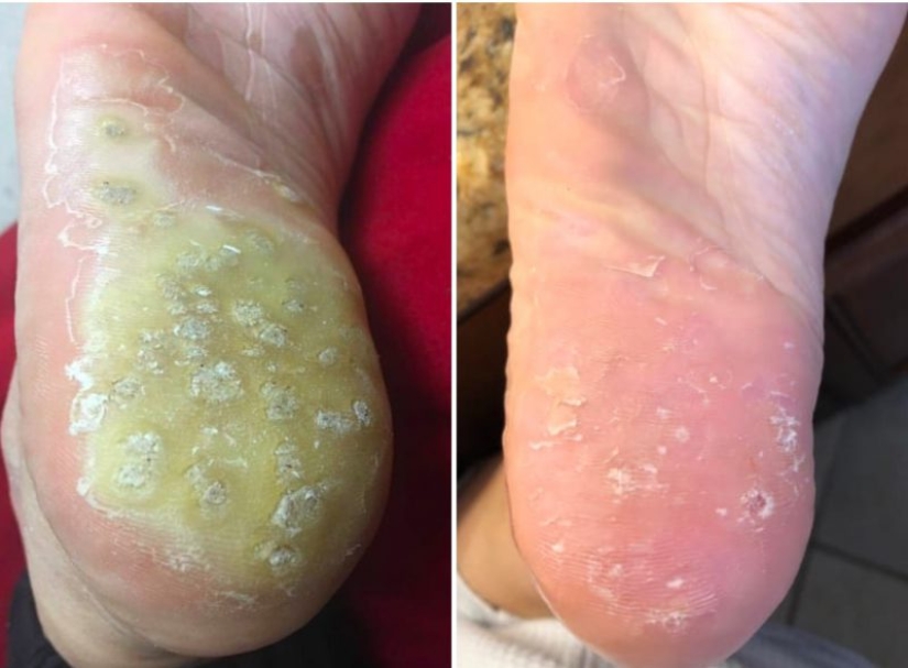 Without photoshop: 26 goods from online stores that have confirmed its effectiveness