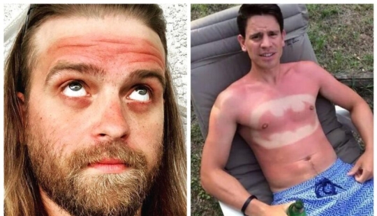 You need to sunbathe wisely, and here are 22 proofs You need to sunbathe wisely, and here are 22 proofs