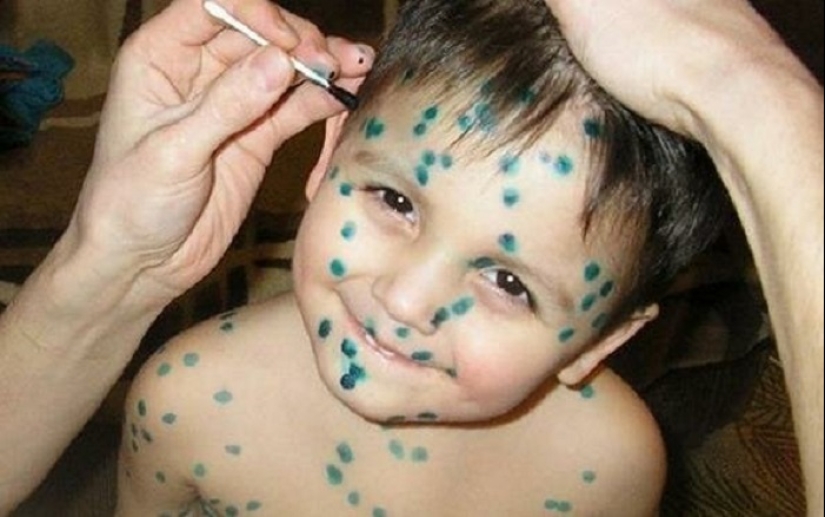 Zelenka y plátano todas las enfermedades: todo sobre la casa de la medicina en la URSS